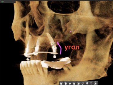 ���� �� ����: �������� ����������� ��� ���?